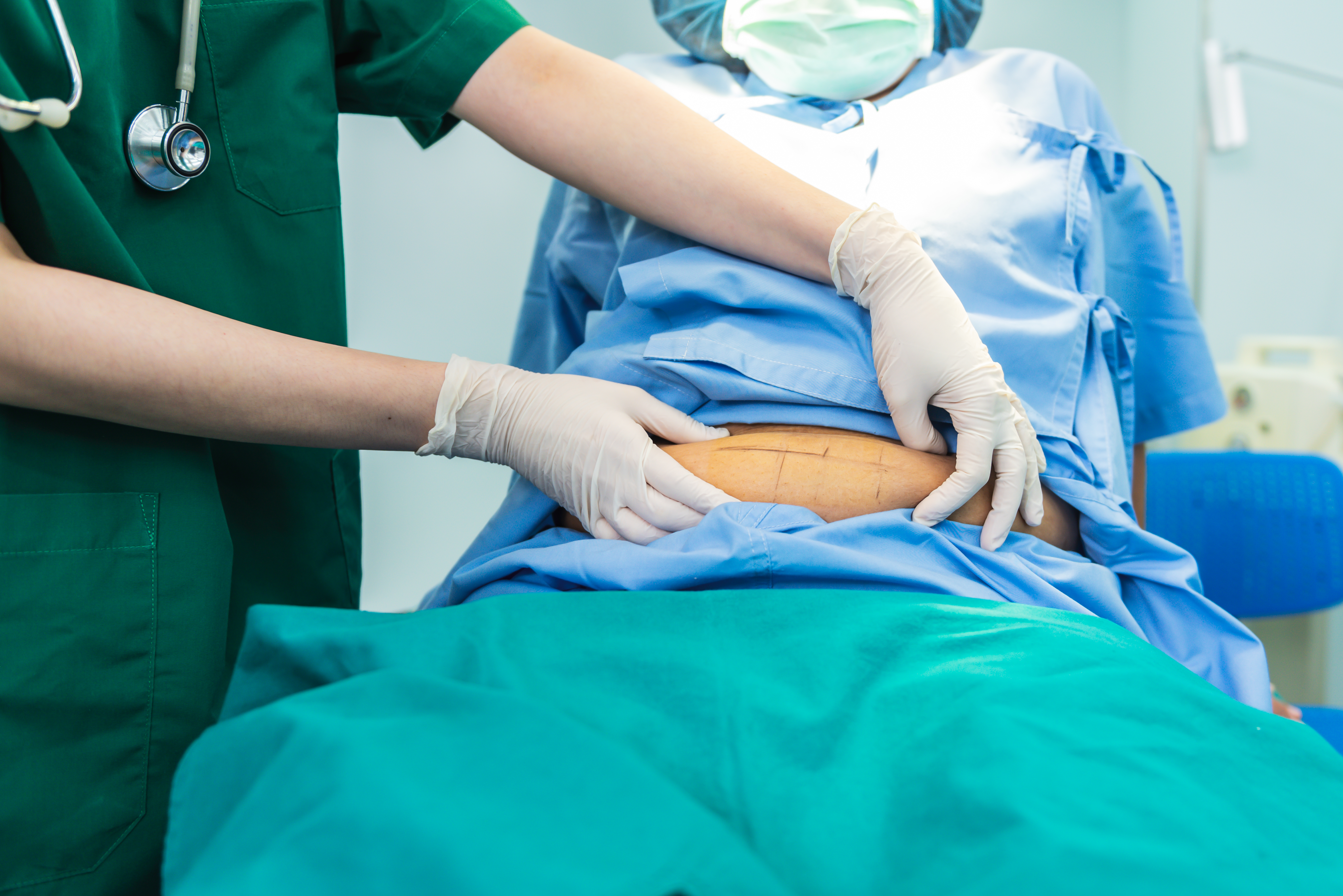 Gastric Sleeve Surgery